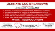 Load image into Gallery viewer, Ultimate EKG Breakdown (2nd Ed)