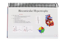 Load image into Gallery viewer, Ultimate EKG Breakdown (1st Ed)