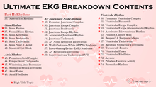 Load image into Gallery viewer, Ultimate EKG Breakdown (2nd Ed)
