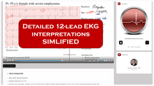 Load image into Gallery viewer, Online EKG Course