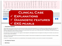 Load image into Gallery viewer, Online EKG Course