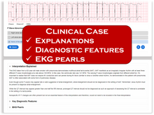 Load image into Gallery viewer, Online EKG Course
