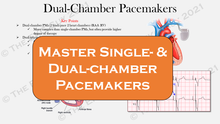 Load image into Gallery viewer, Ultimate Pacemaker Breakdown (1st Ed)