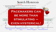 Load image into Gallery viewer, Ultimate Pacemaker Breakdown (1st Ed)