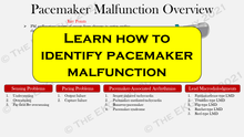 Load image into Gallery viewer, Ultimate Pacemaker Breakdown (1st Ed)