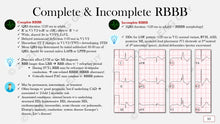 Load image into Gallery viewer, Ultimate EKG Coding Breakdown (1st Ed)