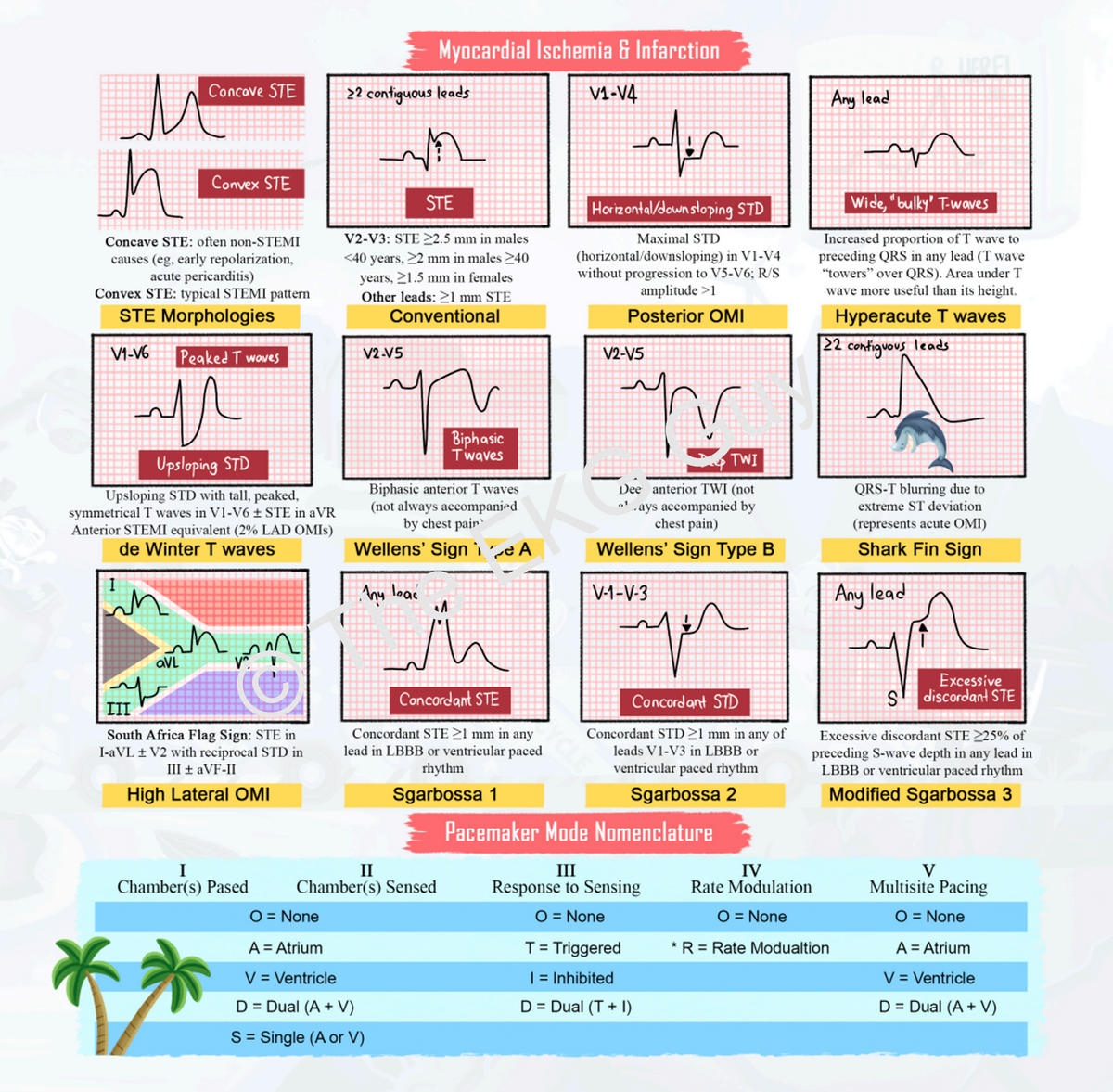 My First Ekg Book: Super Cycle – The Ekg Guy