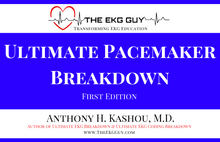 Load image into Gallery viewer, Ultimate Pacemaker Breakdown (1st Ed)
