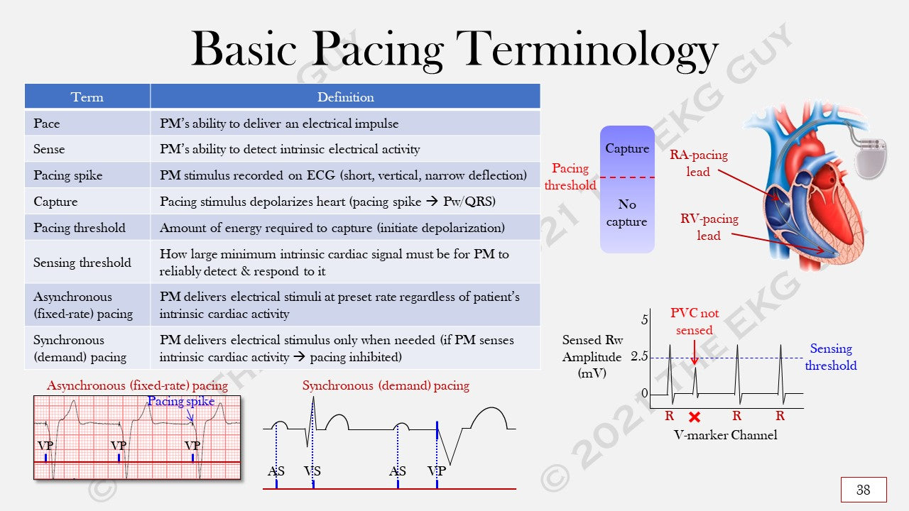 Ultimate EKG Coding Breakdown (1st Ed) – The EKG Guy
