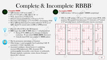 Load image into Gallery viewer, Ultimate EKG Coding Breakdown (1st Ed)
